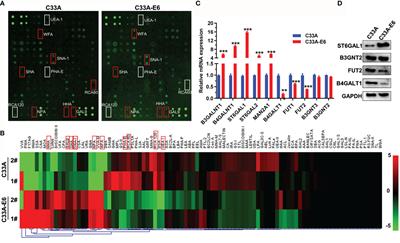 High-Risk HPV16 E6 Activates the cGMP/PKG Pathway Through Glycosyltransferase ST6GAL1 in Cervical Cancer Cells